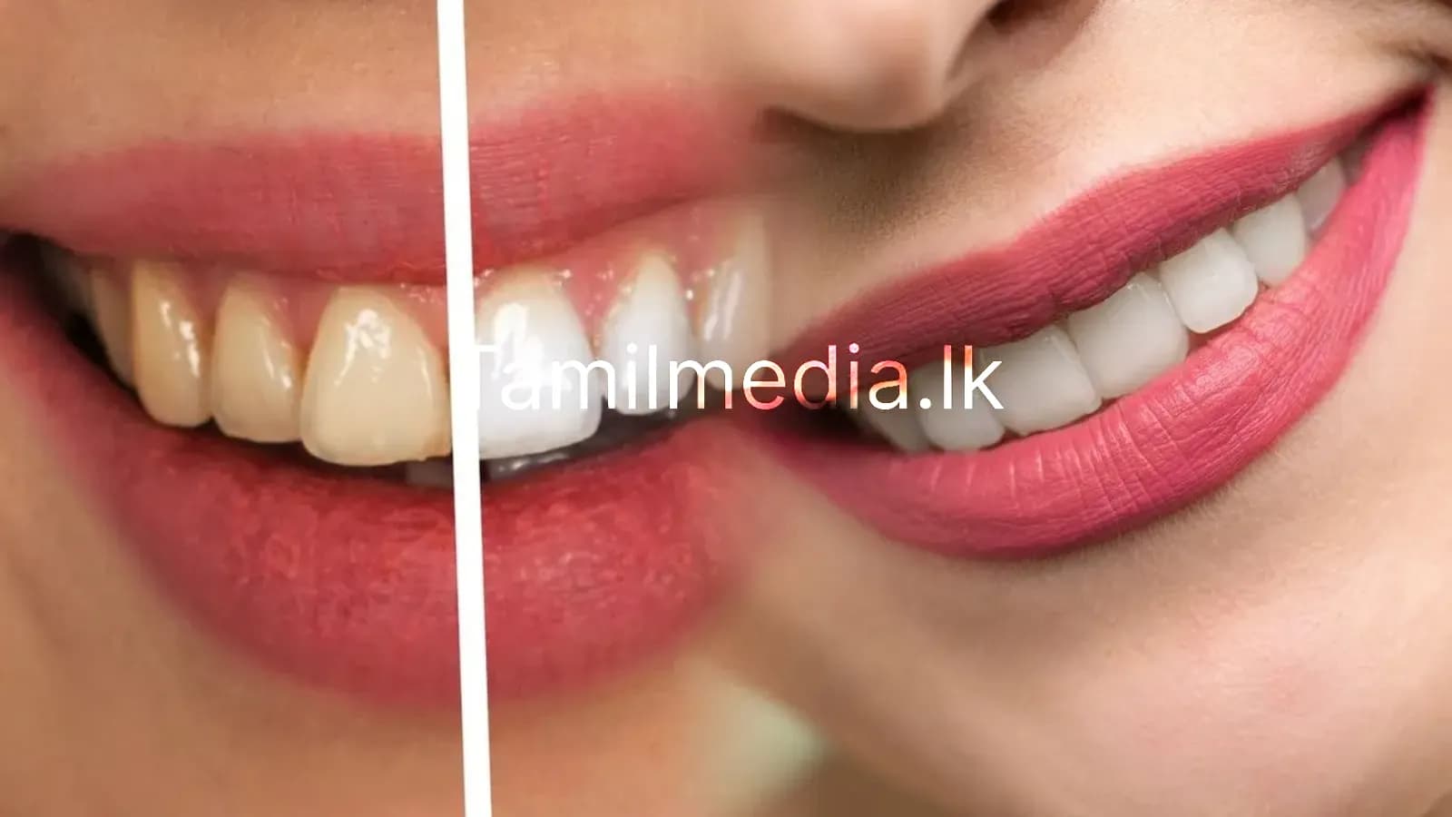 2 நிமிடத்தில் பற்களில் உள்ள மஞ்சளை விரட்டியடிக்கலாம்..!
