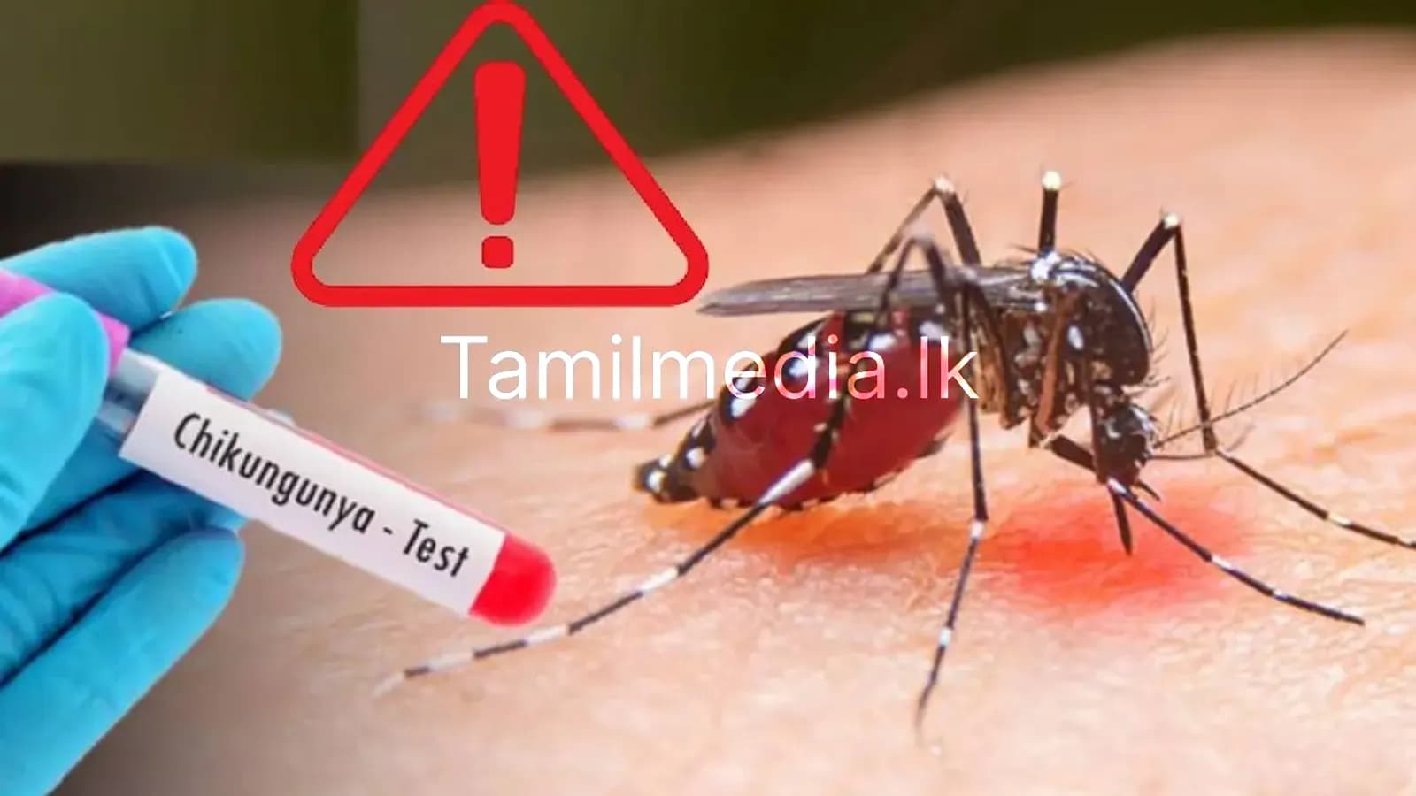 சிக்கன்குன்யா: அறிகுறி மற்றும் சிகிச்சை வழிகள்