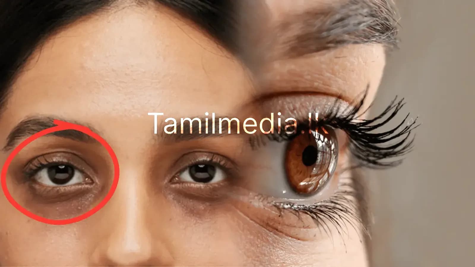 கருவளையம் குறைய இது ஒரு கண்ணியமான தீர்வு!