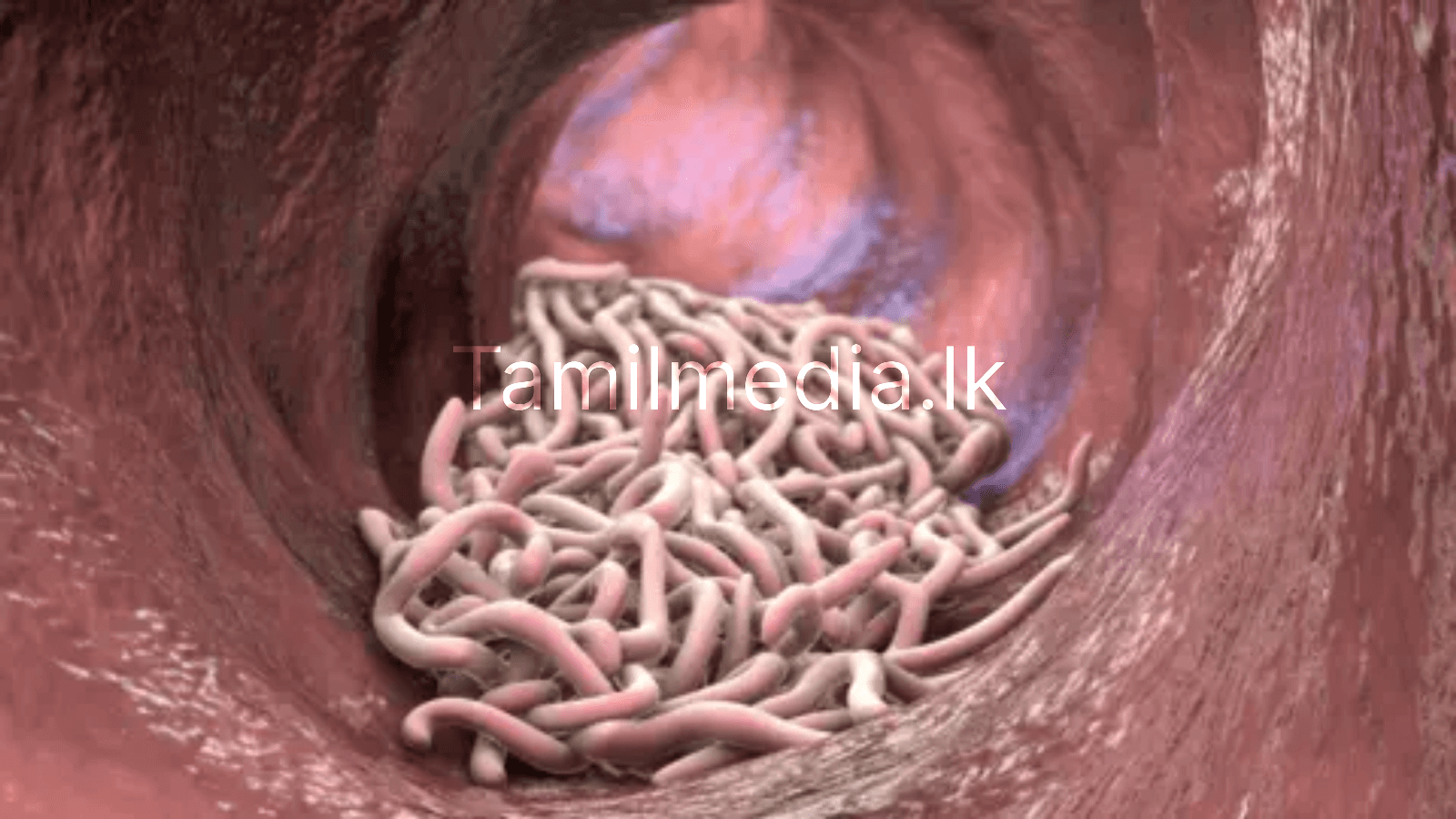 குடல் புழுக்களை 3 நாட்களில் வெளியேற்ற என்ன செய்யலாம்?