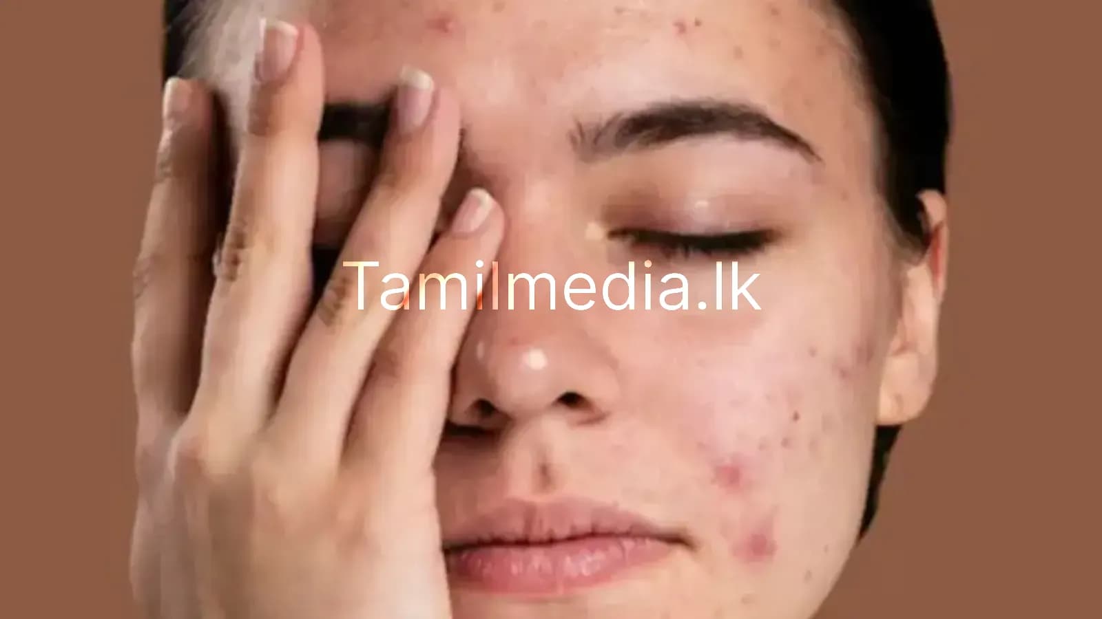 முகக் கரும்புள்ளி நீக்கும் எளிய வீட்டு முறைகள்