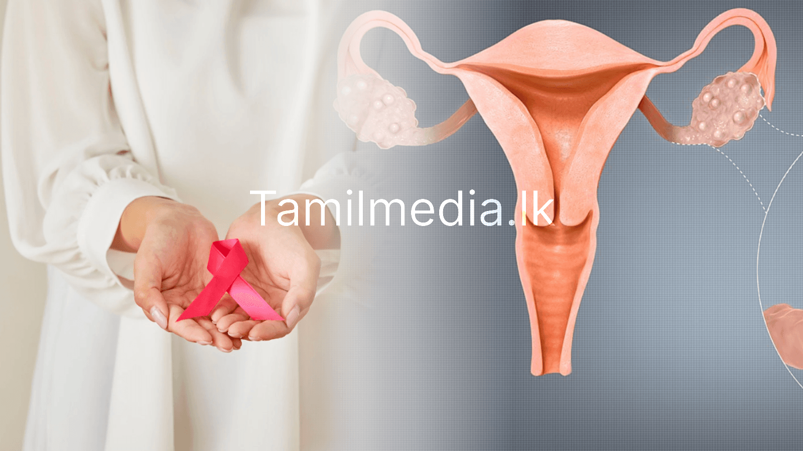 PCOS உங்கள் மார்பக ஆரோக்கியத்தையும் பாதிக்குமா?