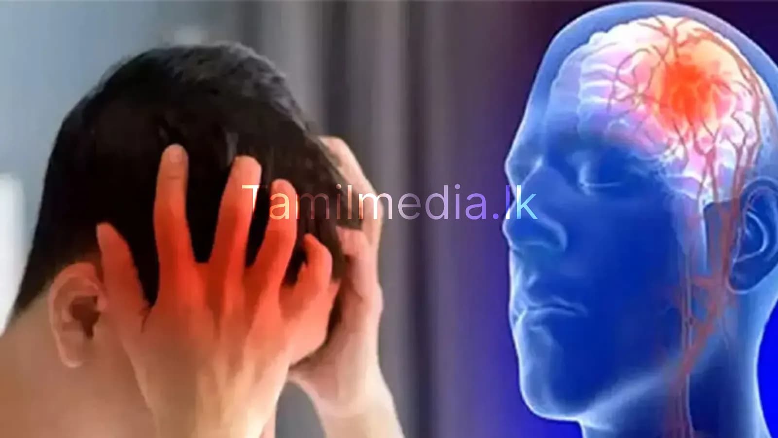 நால்வரில் ஒருவருக்கு பக்கவாதம் அபாயம்